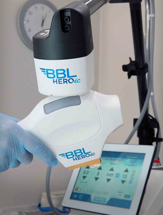 BBL HEROic